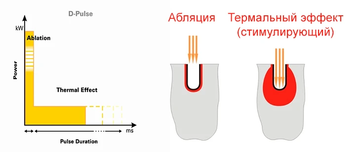 Форма импульса D-Pulse™