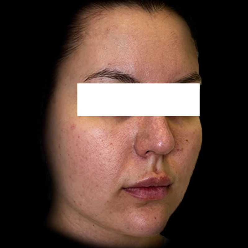 Ultra Skin Solution