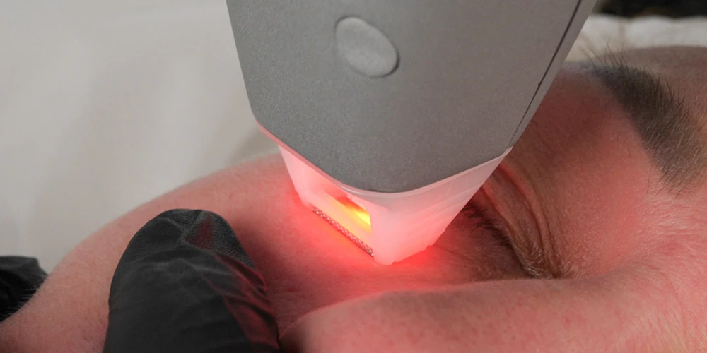 iXtron Fractional