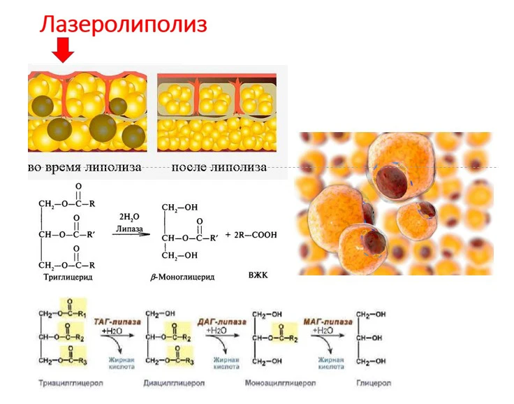 лазер SLIMUS