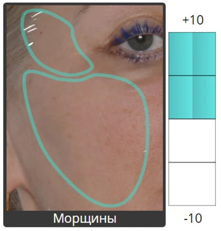 Протокол процедуры Peach Peel PRO и Colibriderm Hydro, фото до