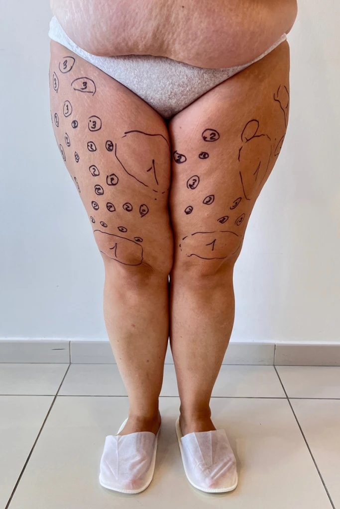 ...