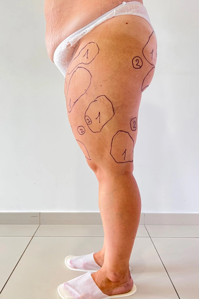 ...