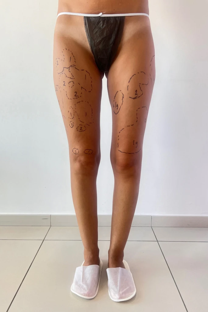...