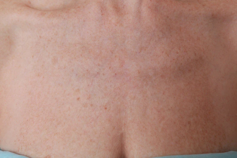 Bio-expander